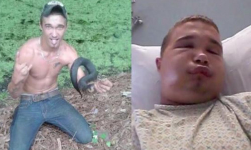 Đây là những gì diễn ra sau nụ hôn với rắn.