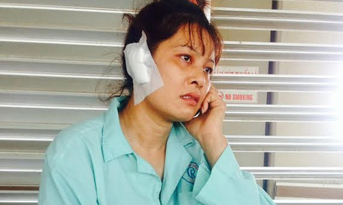 Chị Xuân bị chồng cắn rớt tai phải.