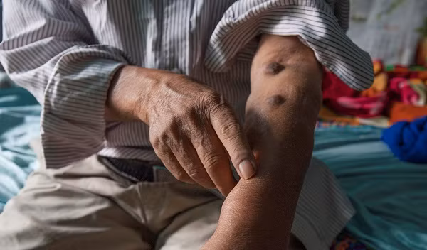 Xot xa manh doi o “xom chay than” giua long thanh pho-Hinh-4