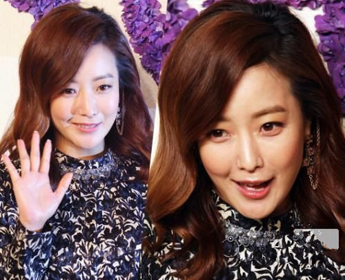 Ngọc nữ Kim Hee Sun từ trước đến nay luôn phủ nhận cô không hề phẫu thuật thẩm mỹ. Thế nhưng khi tuổi tác ngày một nhiều, người ta phát hiện thấy khóe miệng của cô có phần méo mó và gượng gạo.