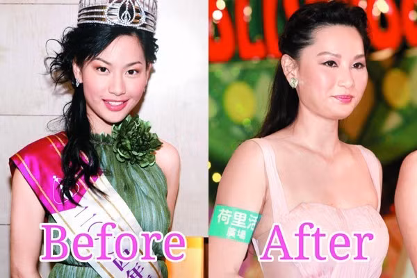 Giai nhân TVB một thời - Từ Tử San - với vẻ mặt cứng đờ, sưng phù do trùng tu nhan sắc. Hình ảnh hiện tại hoàn toàn khác ngày cô mới đăng quang Hoa hậu Hong Kong.