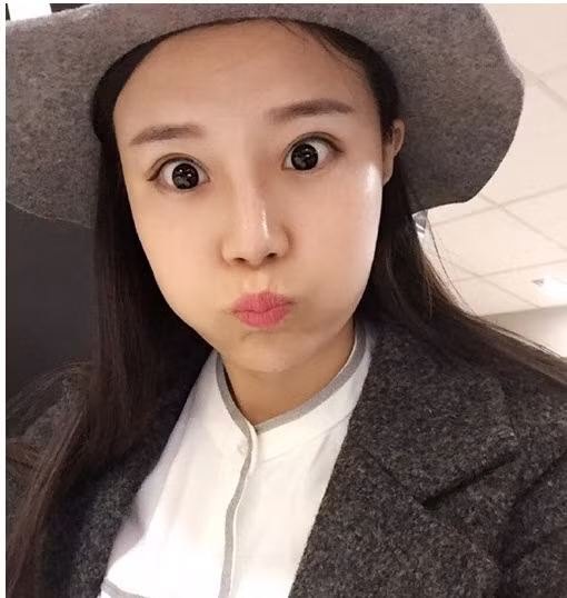 Cô nàng thường phải đội mũ để che đi khuyết điểm.