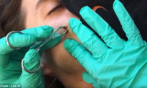 Kinh hai nhung pha nan mun... “tu than” suyt “goi ten” o Viet Nam