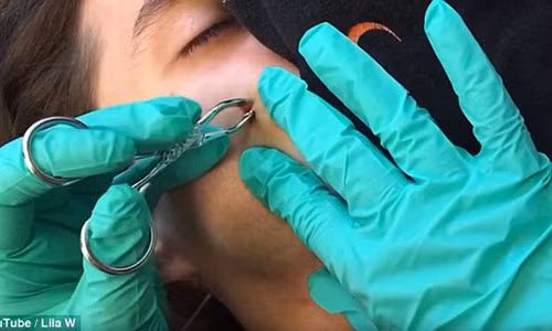 Kinh hai nhung pha nan mun... “tu than” suyt “goi ten” o Viet Nam