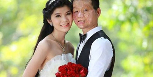 Được biết, cặp đôi vợ chồng đũa lệch - kiều nữ và chàng trai mặt bị biến dạng này đã chia sẻ những hình ảnh họ cùng bên nhau đi làm, đưa con gái đi học và những hình ảnh vui vẻ cùng con gái… Dù những hình ảnh này rất đỗi bình dị nhưng nó lại khiến những người dùng mạng phải ghen tị và ngưỡng mộ.