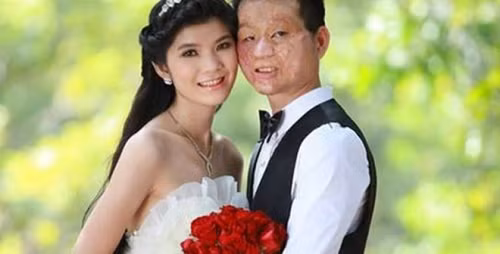 Được biết, cặp đôi vợ chồng đũa lệch - kiều nữ và chàng trai mặt bị biến dạng này đã chia sẻ những hình ảnh họ cùng bên nhau đi làm, đưa con gái đi học và những hình ảnh vui vẻ cùng con gái… Dù những hình ảnh này rất đỗi bình dị nhưng nó lại khiến những người dùng mạng phải ghen tị và ngưỡng mộ.