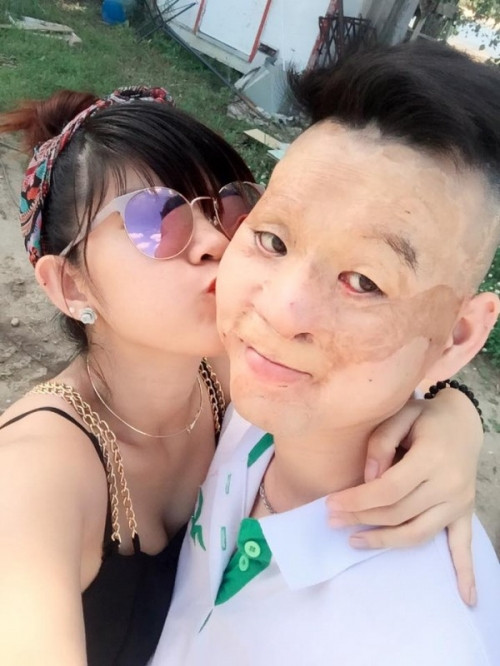 Theo Một thế giới, người chồng trẻ bị biến dạng khuôn mặt kia đang kinh doanh nhà hàng. Còn người vợ xinh đẹp thì đang lo việc nội trợ, chăm sóc con cái. Đặc biệt những tình cảm họ dành cho nhau chân thành khiến nhiều người rất cảm phục.