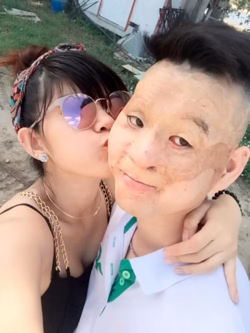 Theo Một thế giới, người chồng trẻ bị biến dạng khuôn mặt kia đang kinh doanh nhà hàng. Còn người vợ xinh đẹp thì đang lo việc nội trợ, chăm sóc con cái. Đặc biệt những tình cảm họ dành cho nhau chân thành khiến nhiều người rất cảm phục.