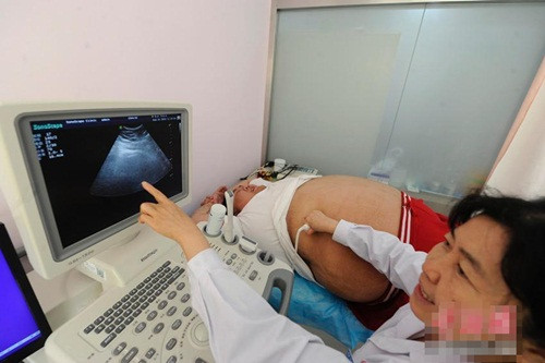 Bác sĩ siêu âm cho Lý Siêu nói rằng việc béo trường kỳ dẫn đến cao huyết áp, mỡ máu và gan nhiễm mỡ nặng.