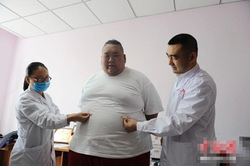 Một cái thước dây dài 1,5m cũng không đo được hết vòng eo của Lý Siêu. Bệnh béo phì thực sự không chỉ cướp mất cơ hội tỏa sáng trên sân khấu của Lý Siêu mà còn ảnh hưởng nghiêm trọng đến sức khỏe của anh.