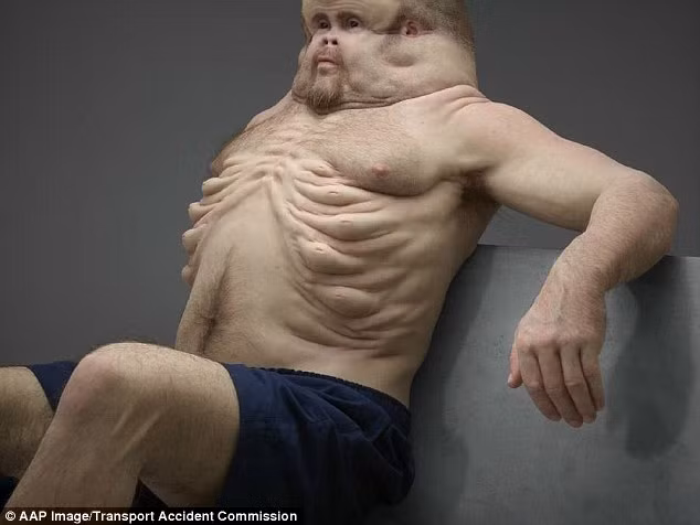 Graham có vòm ngực rộng và nhiều núm vú để bảo vệ khung xương sườn (Ảnh: AAP)