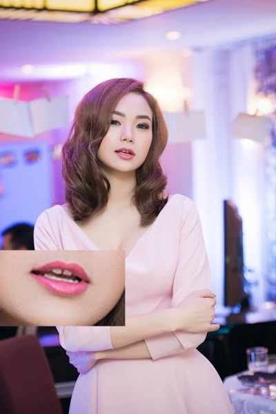 Nữ ca sĩ Minh Hằng sở hữu gương mặt dễ thương, xinh xắn. Tuy nhiên, người đẹp lại có khuyết điểm ở hàm răng với hai chiếc răng trên cửa cách xa nhau khiến khuôn miệng cô trở nên giảm bớt sự sức hút.
