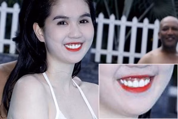 "Nữ hoàng nội y" Ngọc Trinh thu hút người đối diện với gương mặt ngây thơ và thân hình khá hoàn hảo. Nhưng nhược điểm cười hở lợi nhiều đã làm cho nụ cười Ngọc Trinh kém sang trọng.