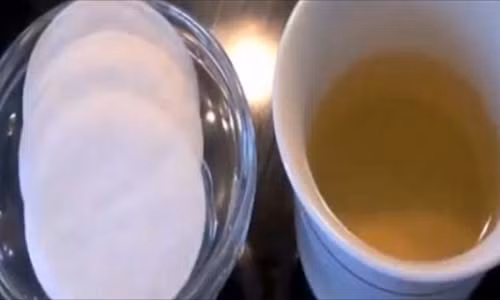 Chua dau bung cam cum chi bang mieng bong gon