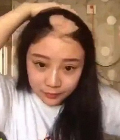 Trước đó, một cô gái cũng phải trả giá đắt vì liều lĩnh tham gia thách thức này. Lọn tóc của cô bị cuốn vào máy khoan khiến cô bị lột cả một mảng da đầu. Thử thách "gặm ngô bằng máy khoan" do một người có tên là Eater Yang khởi xướng trên mạng Internet. Anh này đã đăng tải những đoạn video dùng răng gặm sạch bắp ngô đang quay nhanh trên đầu mũi khoan.