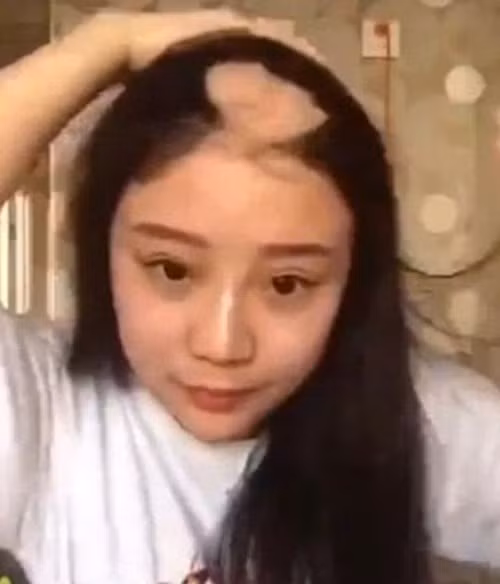 Trước đó, một cô gái cũng phải trả giá đắt vì liều lĩnh tham gia thách thức này. Lọn tóc của cô bị cuốn vào máy khoan khiến cô bị lột cả một mảng da đầu. Thử thách "gặm ngô bằng máy khoan" do một người có tên là Eater Yang khởi xướng trên mạng Internet. Anh này đã đăng tải những đoạn video dùng răng gặm sạch bắp ngô đang quay nhanh trên đầu mũi khoan.