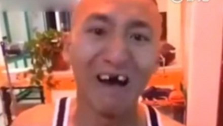 Tuy nhiên, chàng trai đã nhận lãnh một cái kết đắng lòng. Chỉ vài giây sau khi bắp ngô chạm miệng, anh chàng khóc thét vì toàn bộ răng cửa đã "bay" sạch.