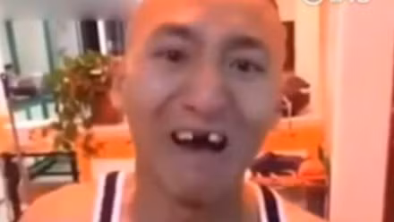 Tuy nhiên, chàng trai đã nhận lãnh một cái kết đắng lòng. Chỉ vài giây sau khi bắp ngô chạm miệng, anh chàng khóc thét vì toàn bộ răng cửa đã "bay" sạch.