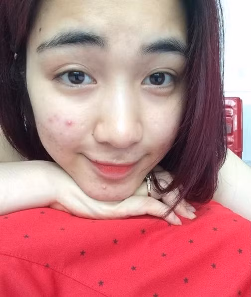 Nhan sac that cua tinh cu Cong Phuong khien nhieu nguoi bat ngo