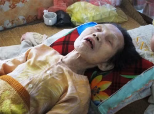 Ly ky chuyen nguoi chet song lai khien bac si cung kinh ngac-Hinh-2