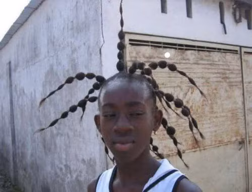 Mọi người nghĩ một con nhện khổng lồ đậu trên đầu chàng thiếu niên này.