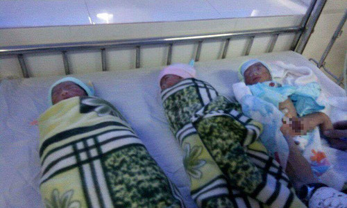 Hiện, sức khỏe của 3 cháu bé và sản phụ đã ổn định.