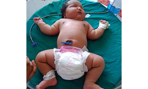 Bé gái sơ sinh 6,8 kg vừa chào đời ở Ấn Độ.