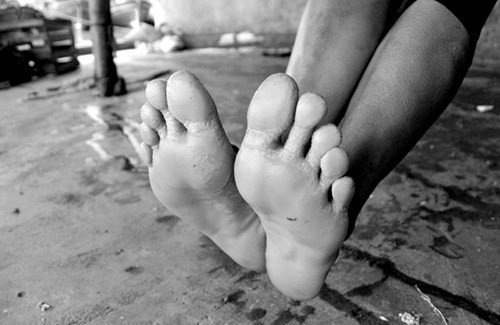 Bàn chân của những người phụ nữ này nhợt nhạt, da bị bong tróc sau một buổi làm việc vất vả.