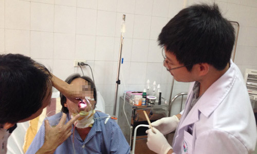 Bệnh nhân ung thư lưỡi được điều trị tại Bệnh viện Việt Nam - Cuba