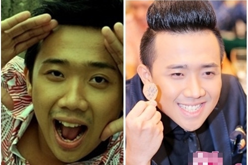 Chỉ sau mấy năm mà ngoại hình của Trấn Thành đã lột xác hoàn hảo.