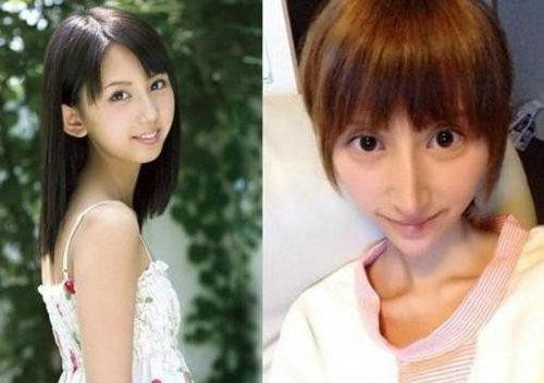 Rumi Kanda, một diễn viên phim AV của Nhật đã quyết định thay đổi bản thân bằng cách phẫu thuật thẩm mỹ. Sau khi lên bàn mổ, Rumi Kanda đã thay đổi không nhận ra vì chiếc mũi biến dạng và cái cằm nhọn hoắt.