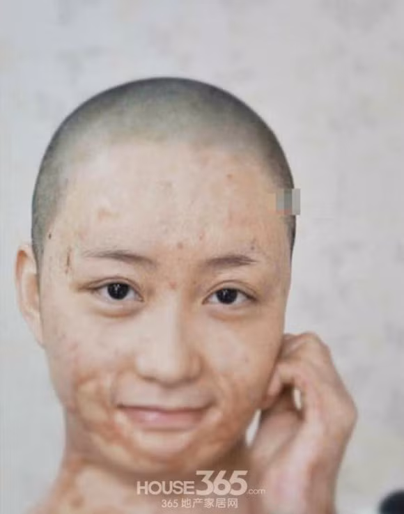 "Tôi đã trải qua 9 lần đại phẫu, 19 lần tiểu phẫu. Sự nghiệp, tương lai, tình yêu đã là con số không. Nhưng tôi vẫn giữ niềm tin ngày mai sẽ tốt đẹp hơn", Lời chia sẻ khiến nhiều người cảm thương cho số phận của cô.