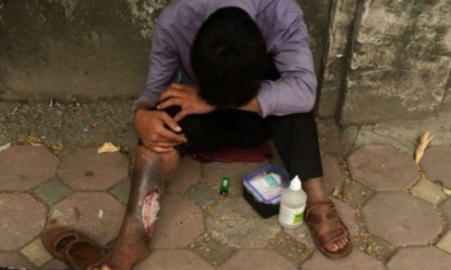 Bi danh bam dap vi gia hoai tu chan de an xin