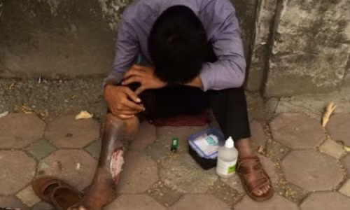 Bi danh bam dap vi gia hoai tu chan de an xin