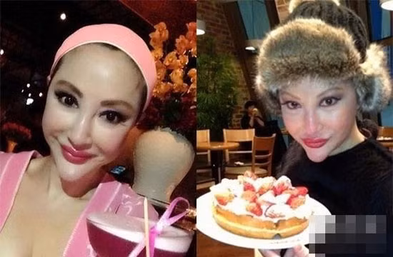 Nữ minh tinh gạo cội của điện ảnh Hong Kong Tiết Chỉ Luân khiến khán giả và người hâm mộ khóc thét khi nhìn thấy khuôn mặt ngày càng biến dạng vì gọt cằm, nâng mũi quá đà của cô.