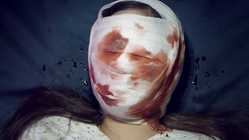 Cô gái vì muốn có được khuôn mặt giống như bố mẹ và những người xung quanh mà nhận được kết cục cay đắng ngay trên bàn phẫu thuật.