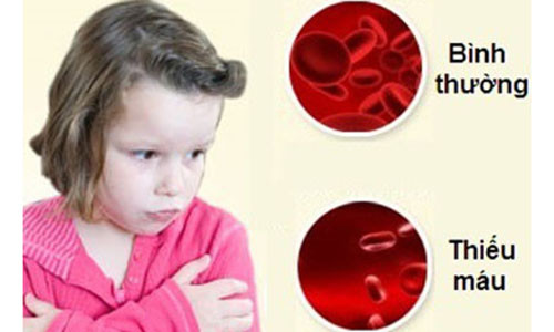 Nguyen tac phong thieu mau dinh duong cho tre