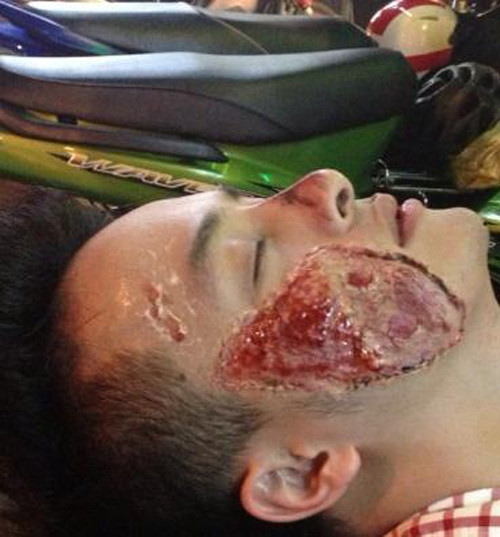 Khi người nổi tiếng chơi trò Cá tháng Tư Chắc hẳn mọi người vẫn còn nhớ trò đùa quái đản của Cao Thái Sơn trong ngày Cá tháng Tư năm ngoái (1/4/2013). Chàng ca sĩ đã dựng lên một kịch bản giả là một tai nạn kinh hoàng. Sau đủ các chiêu trò, anh chàng đã tung hình ảnh tai nạn bị nát mặt trên facebook cá nhân với caption đang phải nhập viện điều trị và ít nhất đến cuối năm mới có thể quay trở lại ca hát. Hơn nữa anh còn tuyên bố chắc nịch: “ Sao mọi người cứ nghĩ Sơn nói đùa thế nhỉ? Có lẽ sẽ hẹn gặp lại các bạn vào cuối năm hoặc vào ngày nào khi Sơn đã sẵn sàng trở lại. Chẳng ai điên mà muốn mình bị thế này cả”. Nhưng sau đó khán giả vô cùng thất vọng khi biết nam ca sĩ mang tình cảm và sự lo lắng của người hâm mộ ra làm trò đùa. Không ít khán giả tỏ ra bức xúc và phản đối cách anh lấy tử thần và tai nạn ra đùa giỡn với chính mình.