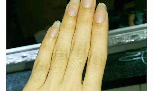 Nhin khe ho ngon tay doan ngay kha nang kiem tien cua ban