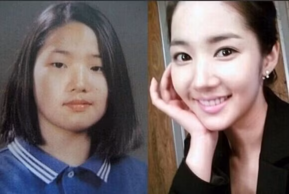 Đôi mắt một mí cùng khuôn mặt thô và bạnh của Park Min Young...