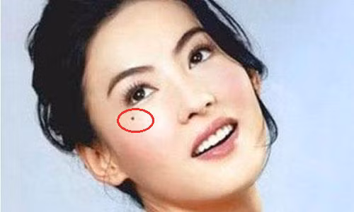 Not ruoi “Le Duong” o phu nu, may man hay dau kho?