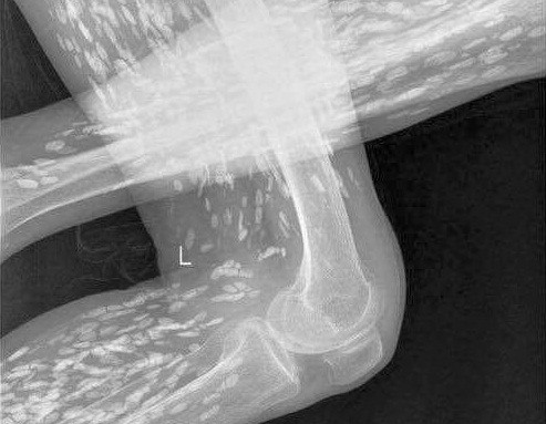 Kinh di san “dao choi” trong co the vi an tiet canh