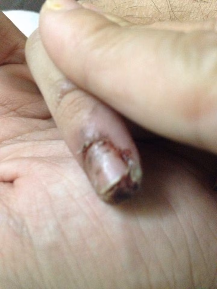 Cu soc tuoi day thi cua chang trai tu ky 15 tuoi-Hinh-3