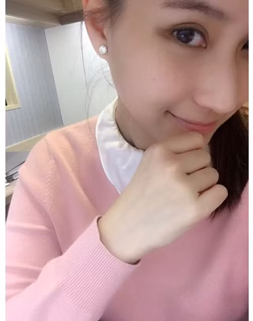 Ngoài vóc dáng, Laurinda còn có một làn da vô cùng đẹp, trắng sáng, mịn màng, không hề có lỗ chân lông hay các dấu hiệu của nám, tàn nhang hoặc quầng thâm mắt. Chính nhờ điều này đã khiến cô nàng có thể tự tin khoe ảnh mặt mộc lên mạng xã hội và rất hiếm khi phải nhờ đến son phấn.