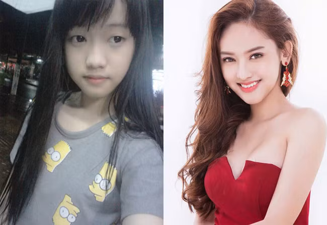 Năm 2015, khi mới được biết đến hot girl Thúy Vi đã không ngần ngại công khai mình từng phẫu thuật thẩm mỹ hai lần, cụ thể là cắt mí và sửa mũi.