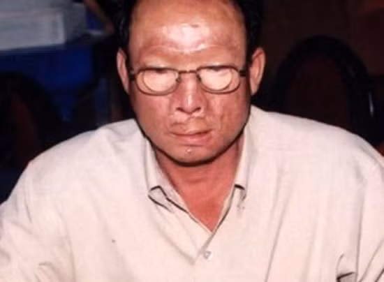 Gương mặt Lâm chín ngón sau khi bị tạt axit. - ảnh: ANTG