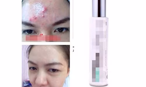 Bi quyet lam dep da bang da quy khien chi em dien dao