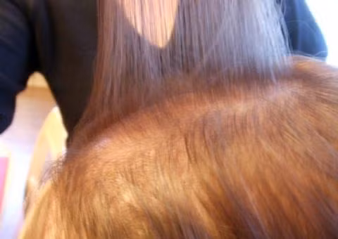 Diem mat 5 nguyen nhan gay rung toc o phu nu