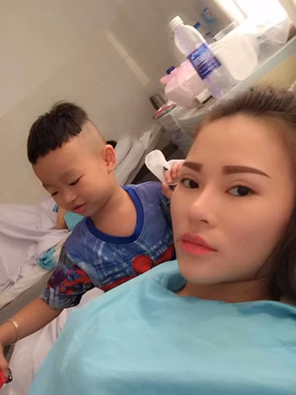 Cô gái chia sẻ, phẫu thuật thẩm mỹ là quá trình đau đớn, đau gấp 10 lần mổ đẻ.