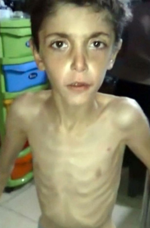 Noi chien Syria khien nguoi dan tro thanh 